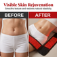 🔥🔥Advanced Red Light Therapy Belt