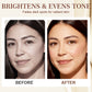 ⏰🎁5% Tranexamic Acid Brightening Serum